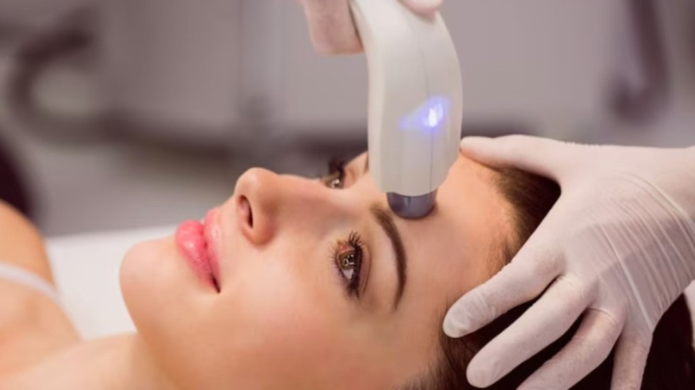 Ultrassom Microfocado vira moda entre os procedimentos de beleza