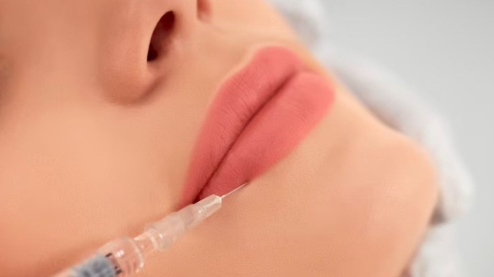 Preenchimento labial segue em alta. Veja mitos e verdades do método