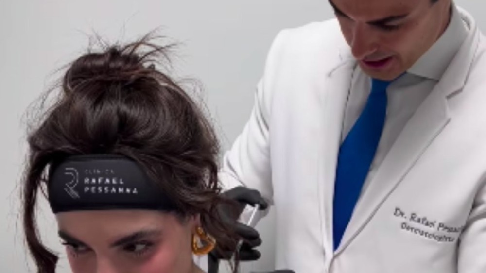 Gkay fez aplicação de 'Barbie Botox'. Descubra o que é o procedimento
