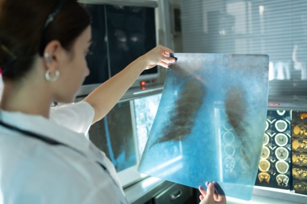 Comissão debate eliminação da tuberculose como problema de saúde pública