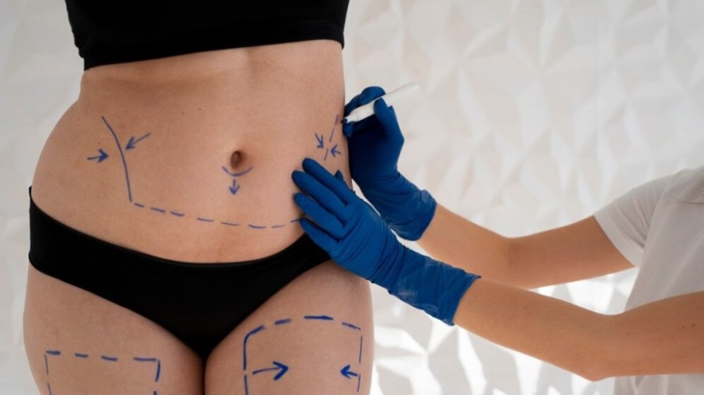 Cirurgião lista principais tendências da cirurgia plástica para 2024