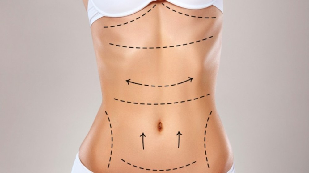 Cinco verdades que todos precisam saber antes de realizar uma lipo