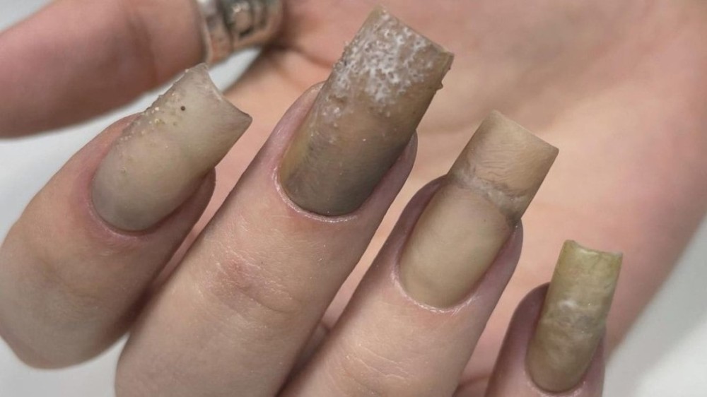 Rotten Nails: Conheça tendência que imita unhas 