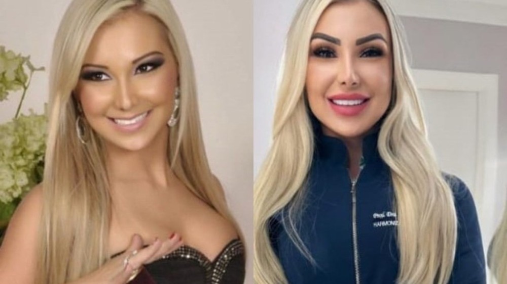 Fernanda Passon abre o jogo sobre procedimentos estéticos